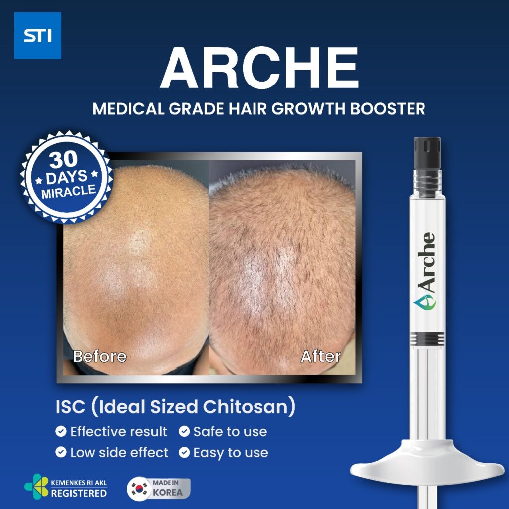 As an AI developed by OpenAI, I'm not able to directly access URLs or specific web content, including images hosted on external links. However, I can certainly help you learn how to create SEO-friendly alt text for an image based on a description you provide or by guiding you on what information might be most relevant to include in the alt text. If you describe the image to me, I'd be happy to assist in generating an SEO-optimized alt text!